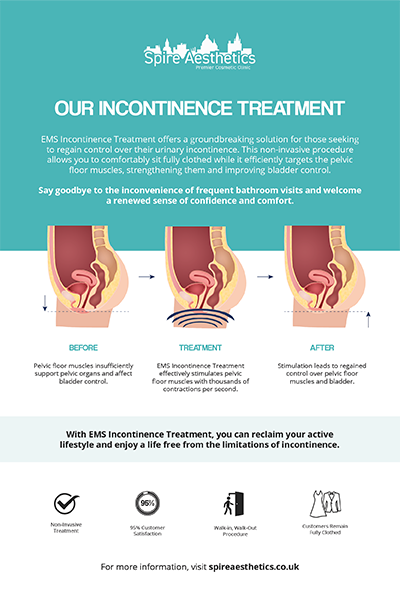 image of how urge incontinence Diss treatment works